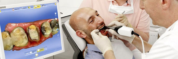Cerec | DENT+ Zubná klinika